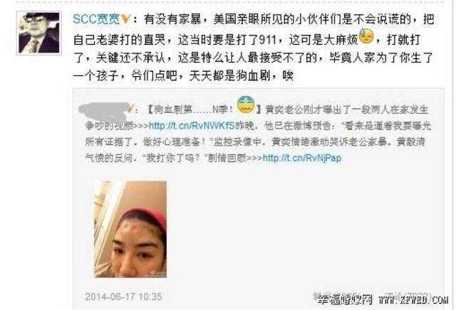 随后,黄奕也晒出了自己被黄毅清打过后的照片… 虽然不雅视频因为打