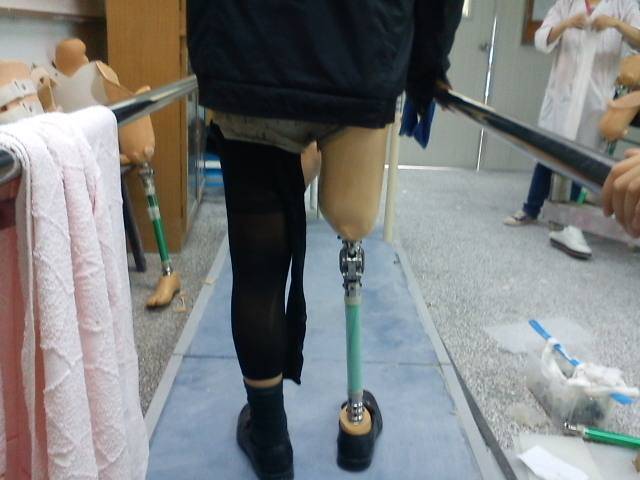 大腿假肢行走练习训练步骤