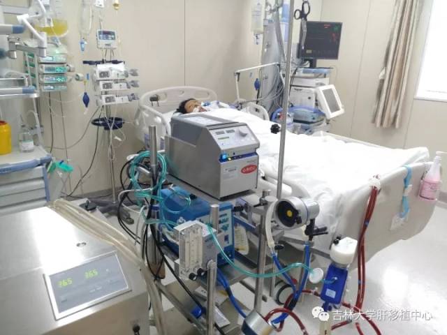 患者肝移植术后ecmo辅助下于icu病房康复中