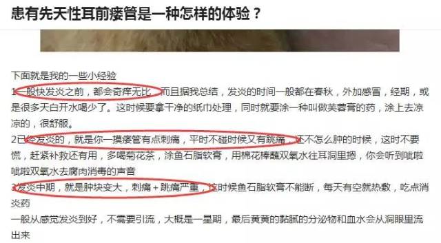这个小洞被美化多年,可事实是多人因它动手术!