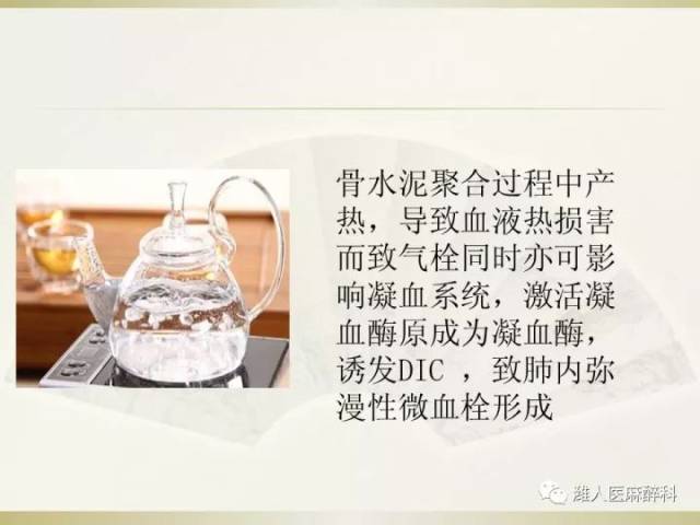 15张图片带你了解骨水泥植入综合征那些事儿