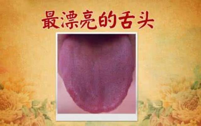舌头上边的"舌苔"颜色不一样代表身体有病?这种颜色一定要注意了!