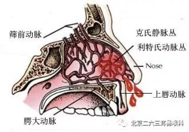 鼻出血的"自白"