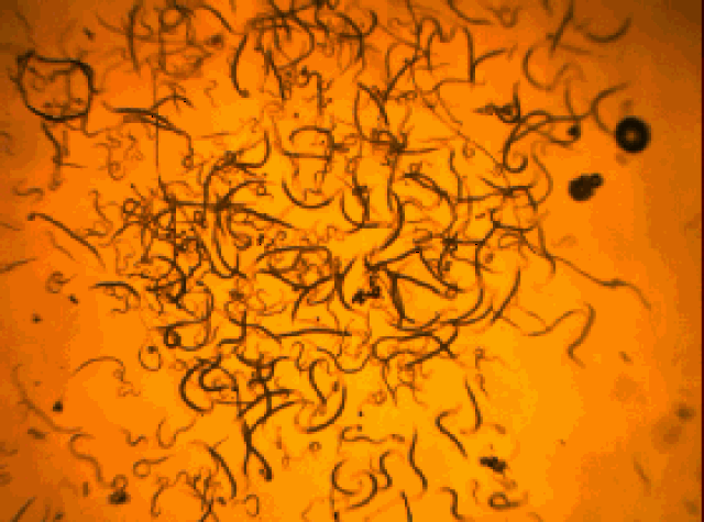 显微镜下的根结线虫原来长这样!高清组图让你全面了解这货的前世今生!