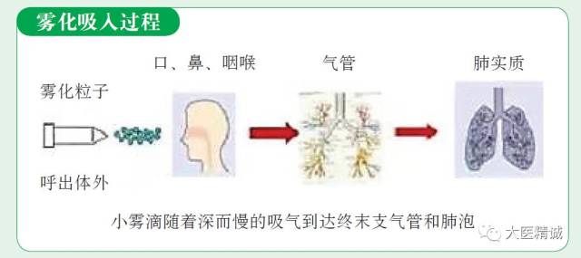 301出品一图看懂:超声雾化吸入,轻松排痰