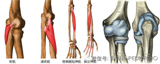 肱骨外髁骨折骨折线被关节液浸泡,以及骨折块被伸肌总腱的持续牵拉是