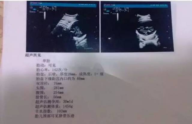 b超单能看男女?超简单的方法教你看懂b超单的秘密!
