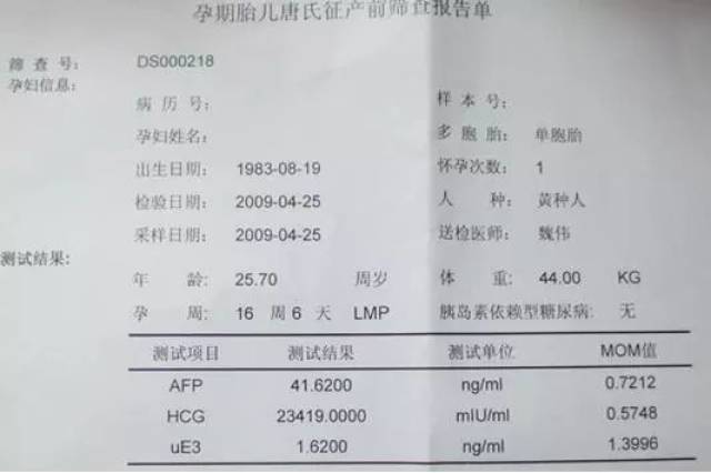 b超简谱
