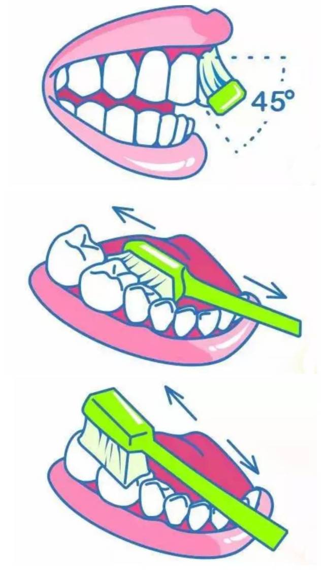 用巴氏刷牙法,按摩牙龈
