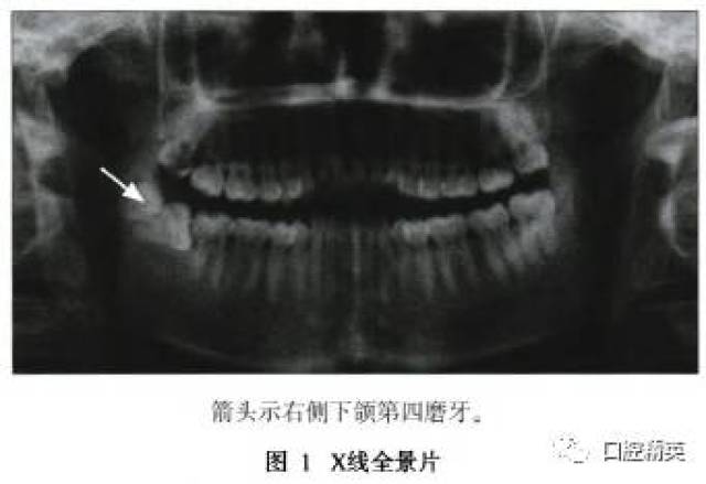 牙龈反复肿痛,是何原因?