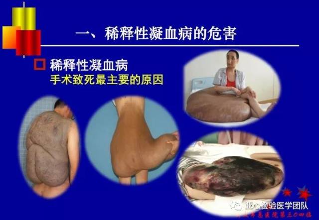 围术期稀释性凝血病的防治