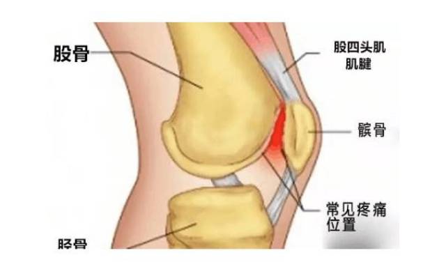 的血管和神经支配,也就意味着髌下脂肪垫也可作为髌骨下膝痛的来源