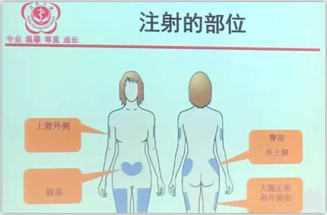 注射低分子肝素——轮换 ● 大轮换 上臂外侧,腹部,臀部外上侧,大腿