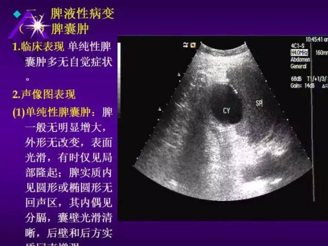 【超声微课堂】脾脏超声诊断