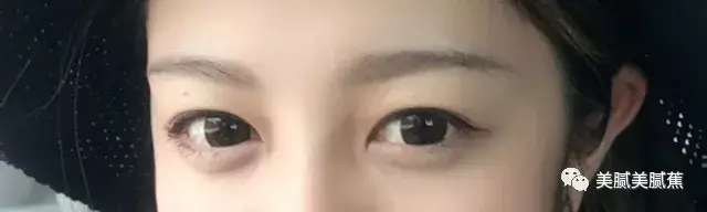 美探:调教单眼皮,内双,肿司机,双眼皮贴老眼泡的经验之谈我被拯救成性奴的经历图片