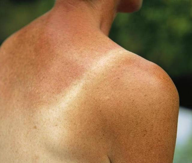 黑色素排出方法 daafaf4d2841417c93c463aa291a9cc7.jpeg