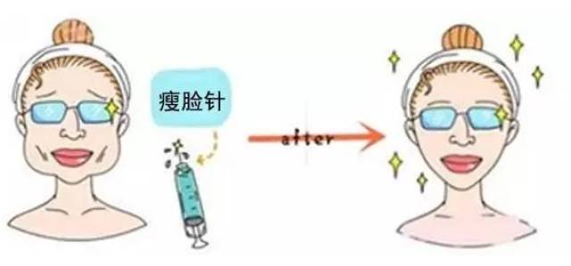 瘦脸针千万别随便打,否则就让人.