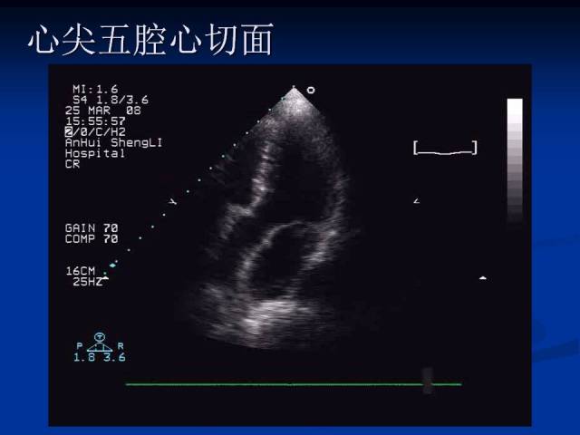 超声心动图基础知识和常用切面