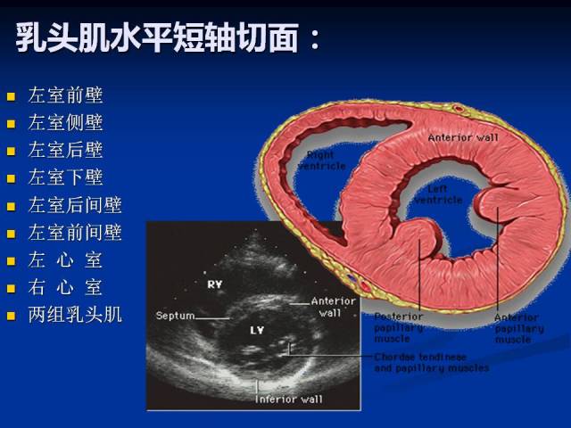 超声心动图基础知识和常用切面