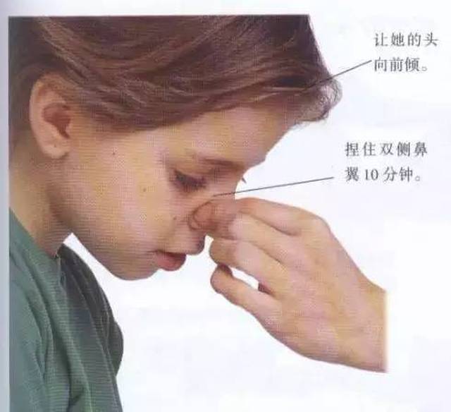 鼻子出血怎么办? 让孩子坐下,头向前倾,要求