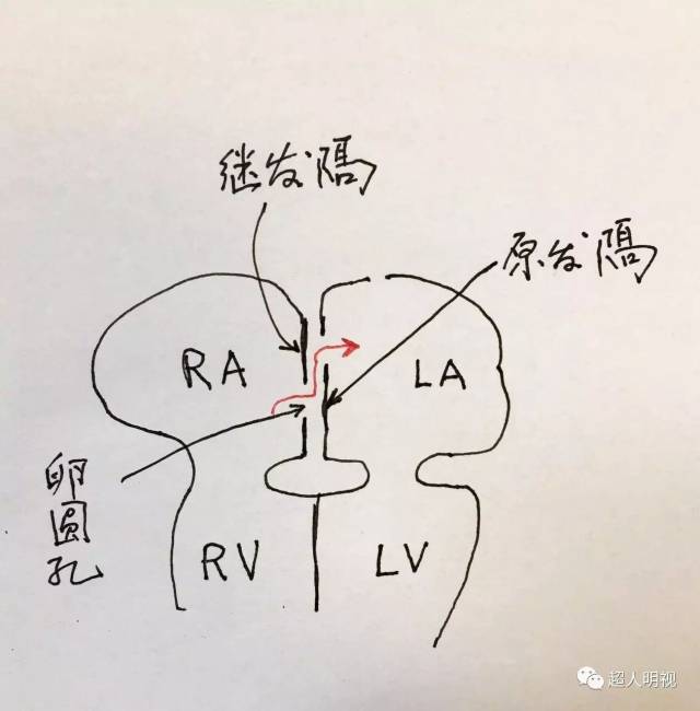 看英文,了解房间隔形成