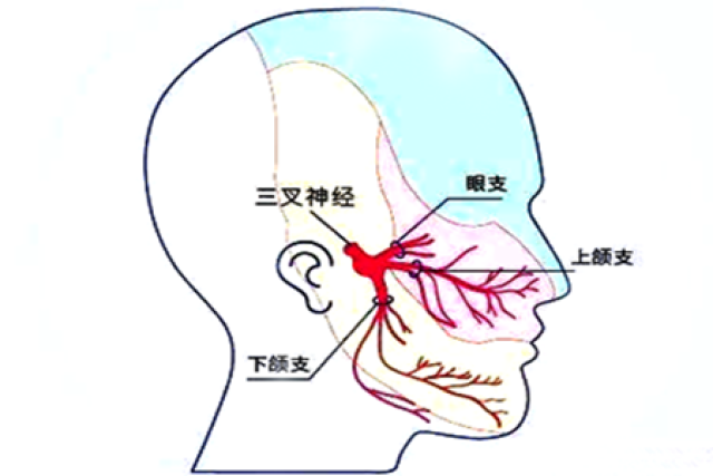 牙痛,还是三叉神经痛?_手机搜狐网