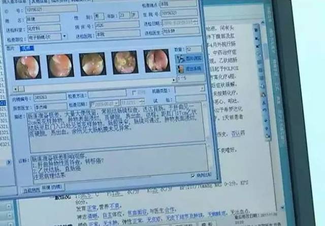 长期拉肚子没在意,中山22岁小伙查出直肠癌!到底怎么回事?