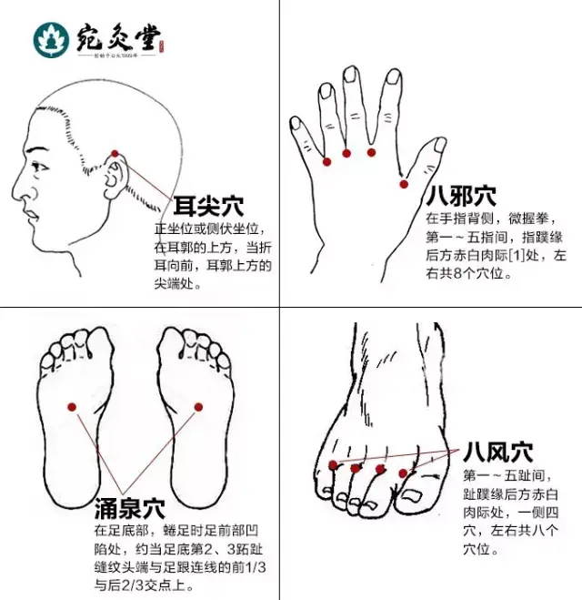 ②子宫肌瘤除了以上穴位再加灸痞根,血海.