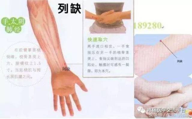 专治头颈问题奇穴—列缺穴