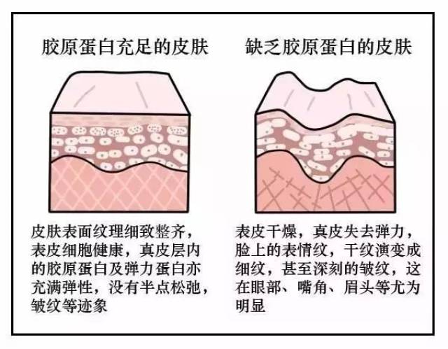 随着年龄的增长,体内胶原蛋白分泌减少,也开始流失,脖子上的皮肤状态