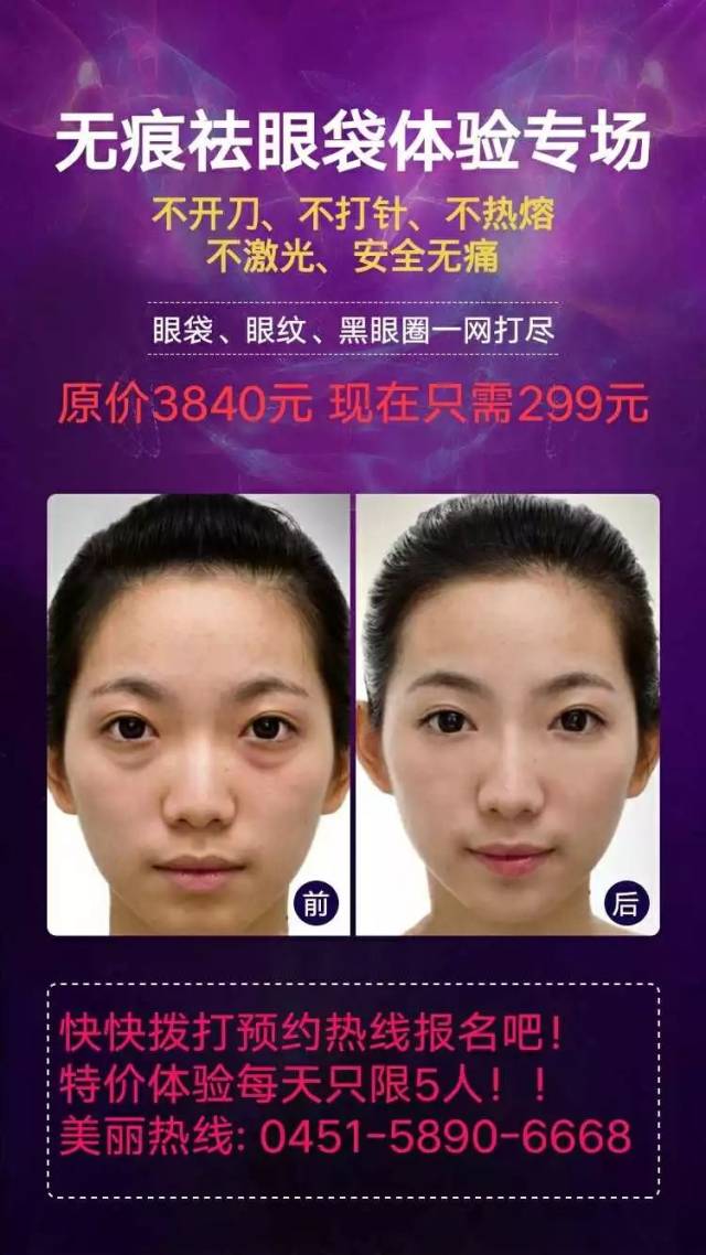 辣么大的眼袋挂脸上不赶紧祛了,难道留着过年吗?