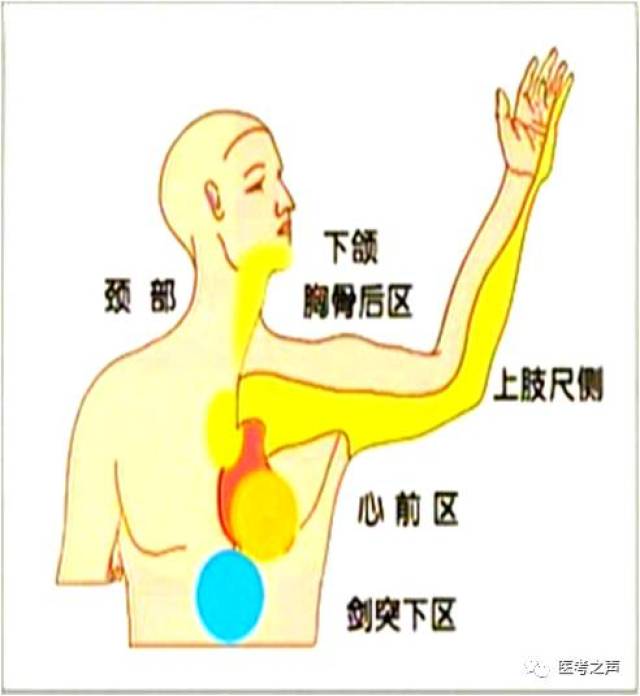 061a5f2964d14e3381a3204e22778a19.jpeg