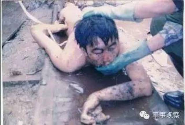 这是战地记者袁熙烈士他也是在黑豹行动中牺牲的 他腹部被炸破 内脏