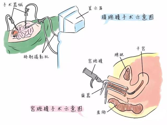 bac48a5221bf4483bd555dcf1f2241bf.jpeg
