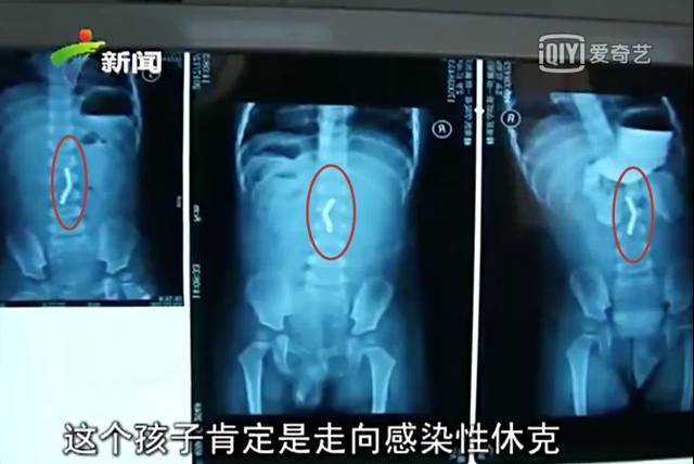 2017“夺命玩具”盘点,千万别再给孩子买了!