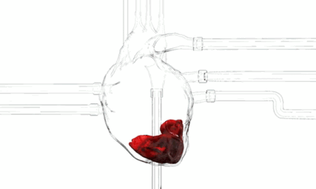 小小感冒也可能会让人送命,体质