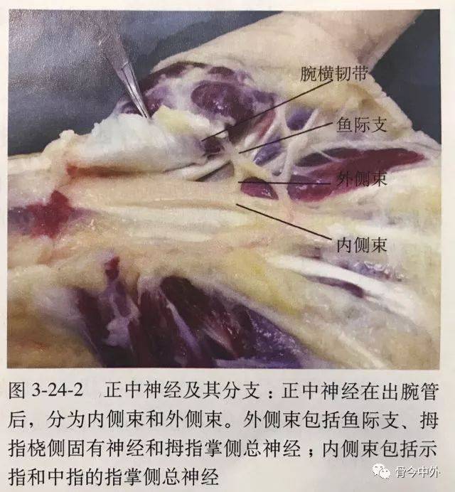 腕管综合征病因分析及手术处理方法精要