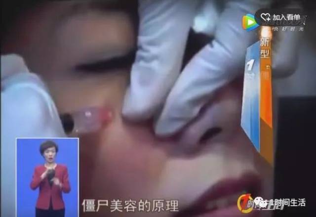 "僵尸美容"成热潮,往脸上"打血"真有用吗?专家却这么提醒