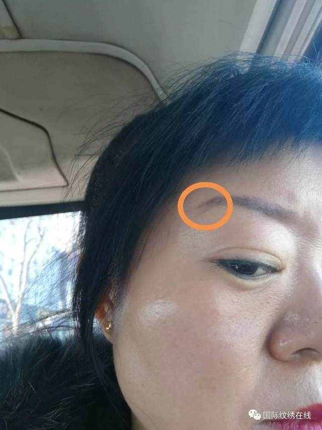 眉毛如果用肤色遮盖的话,有很大的可能会发红,最好的办法还是用激光洗