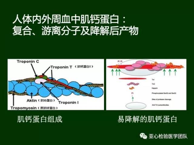 肌钙蛋白检测技术与干扰分析