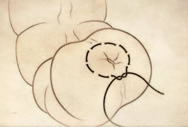 【视频图文】养猪常用外科手术缝合方法