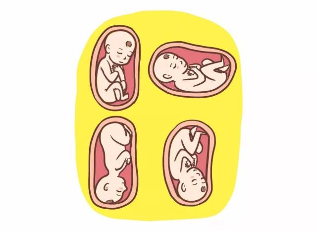 临近预产期,宝宝胎位不正怎么办?