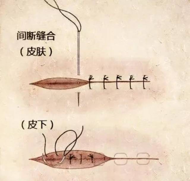 【视频图文】养猪常用外科手术缝合方法