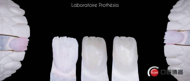 24 cross polarized picture shows internal structures of tooth