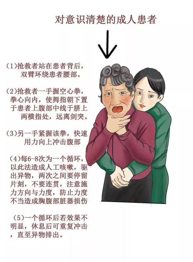 儿童及成人气道异物梗阻的急救常识!