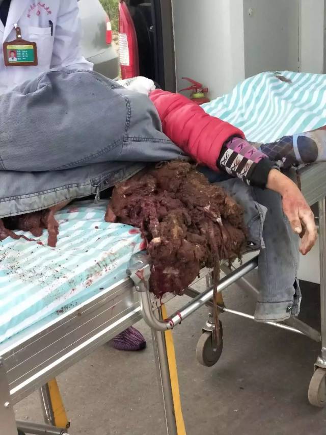 受伤者已经送往医院