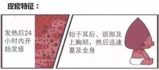 幼儿园猩红热高发 早期症状与感冒