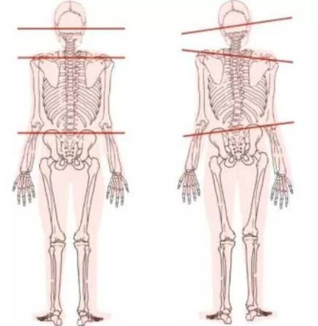 2个动作,拯救你的气质和高低肩!