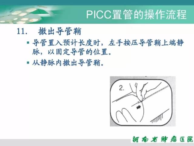 picc置管详细流程及维护步骤,超实用!