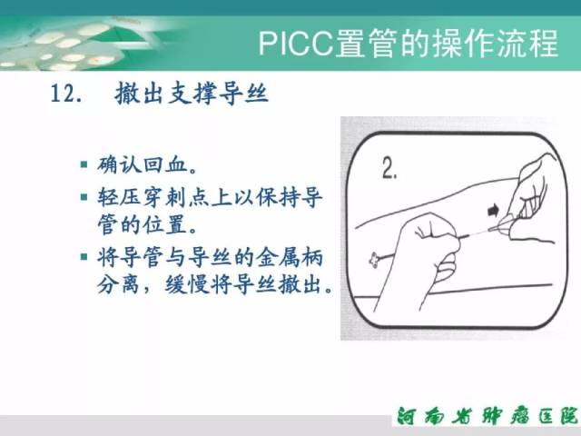 picc置管详细流程及维护步骤,超实用!